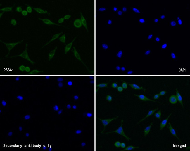 RASA1 Antibody in Immunocytochemistry (ICC/IF)