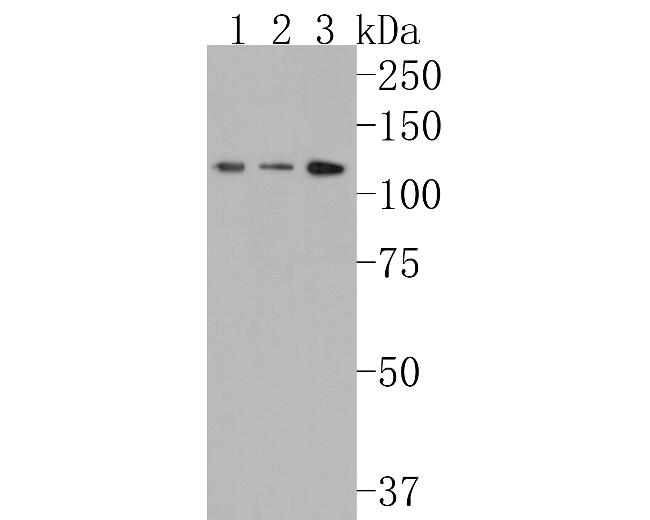 RASA1 Antibody in Western Blot (WB)