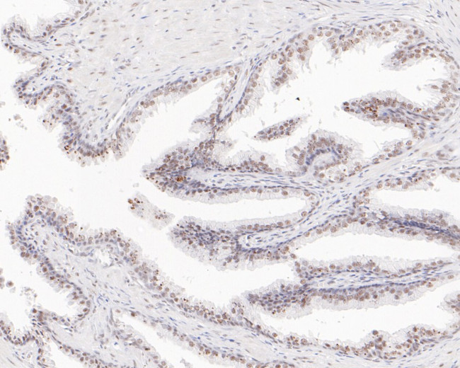 USP39 Antibody in Immunohistochemistry (Paraffin) (IHC (P))