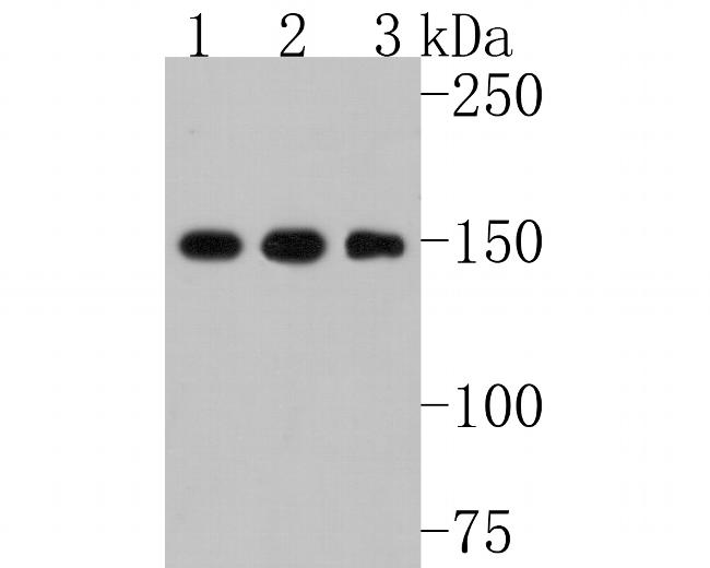 Collagen III Antibody in Western Blot (WB)