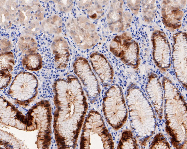 15-PGDH Antibody in Immunohistochemistry (Paraffin) (IHC (P))