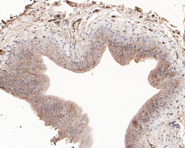 15-PGDH Antibody in Immunohistochemistry (Paraffin) (IHC (P))