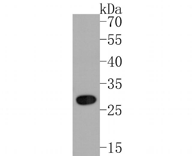 15-PGDH Antibody in Western Blot (WB)