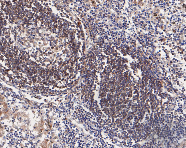 CD79b Antibody in Immunohistochemistry (Paraffin) (IHC (P))