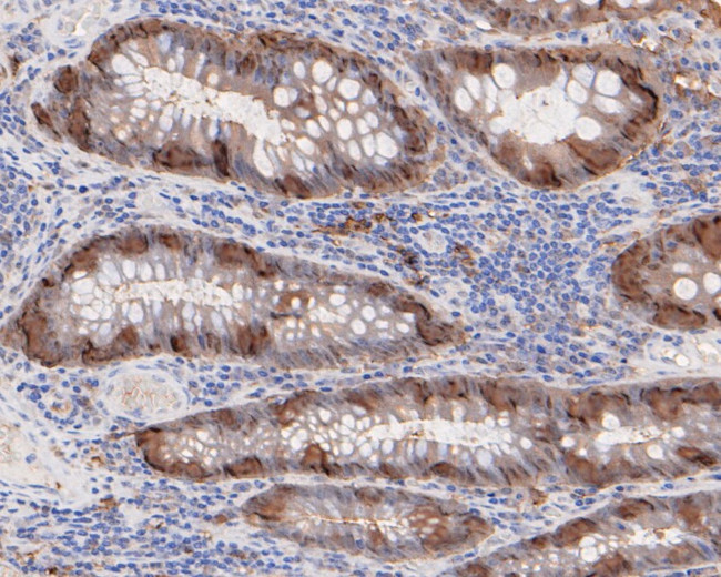 CTNNBIP1 Antibody in Immunohistochemistry (Paraffin) (IHC (P))