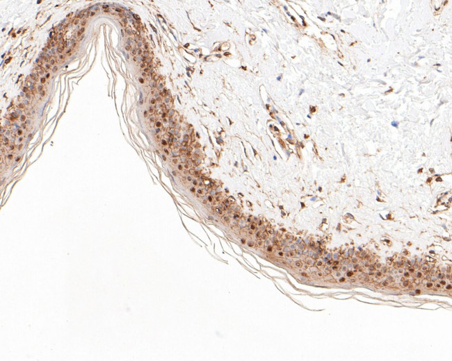 CTNNBIP1 Antibody in Immunohistochemistry (Paraffin) (IHC (P))