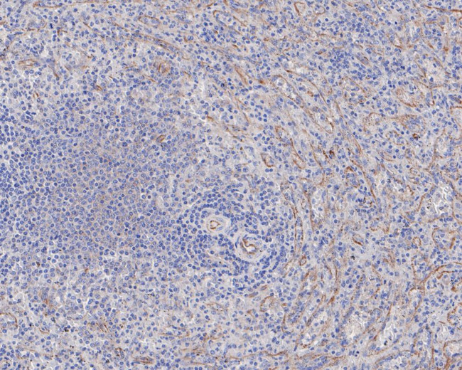 CD84 Antibody in Immunohistochemistry (Paraffin) (IHC (P))
