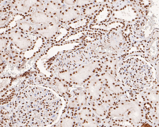 PDCD7 Antibody in Immunohistochemistry (Paraffin) (IHC (P))