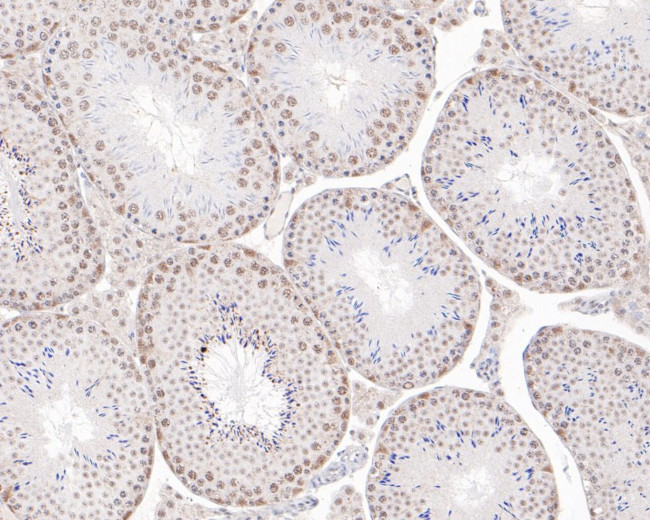 PDCD7 Antibody in Immunohistochemistry (Paraffin) (IHC (P))