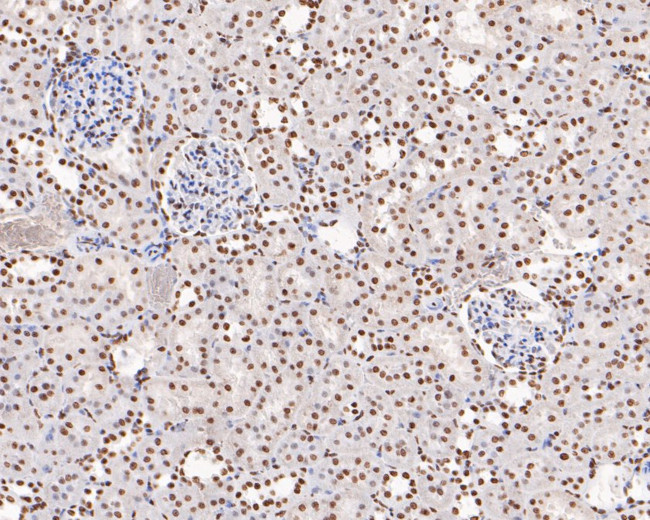 PDCD7 Antibody in Immunohistochemistry (Paraffin) (IHC (P))