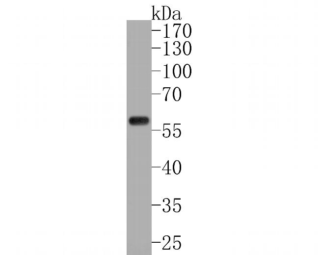 PDCD7 Antibody in Western Blot (WB)