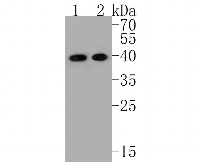 ACAT2 Antibody in Western Blot (WB)