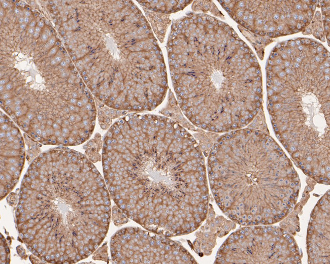 ARPC2 Antibody in Immunohistochemistry (Paraffin) (IHC (P))