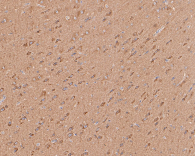 ARPC2 Antibody in Immunohistochemistry (Paraffin) (IHC (P))