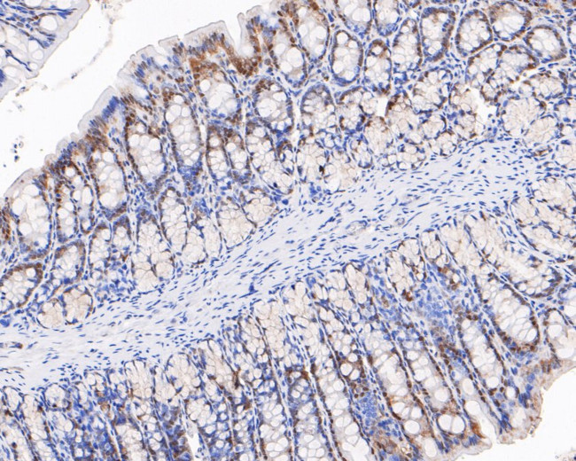 SRP19 Antibody in Immunohistochemistry (Paraffin) (IHC (P))