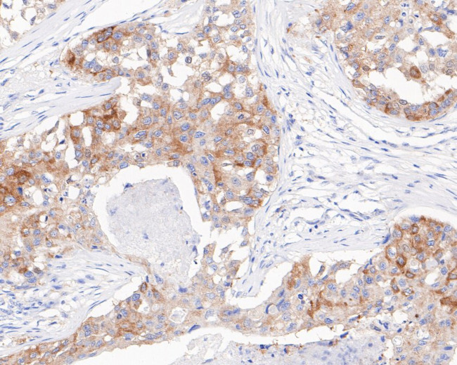 ZPR1 Antibody in Immunohistochemistry (Paraffin) (IHC (P))