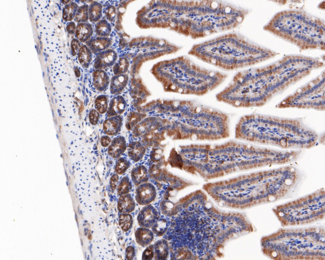 ZPR1 Antibody in Immunohistochemistry (Paraffin) (IHC (P))