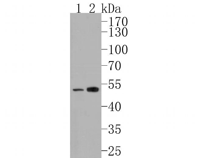ZPR1 Antibody in Western Blot (WB)