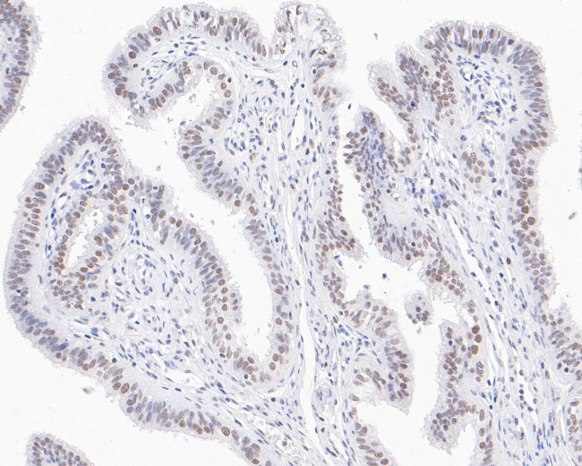 CPSF3 Antibody in Immunohistochemistry (Paraffin) (IHC (P))