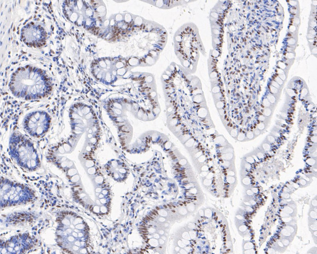 CPSF3 Antibody in Immunohistochemistry (Paraffin) (IHC (P))