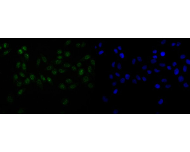 SNRPA1 Antibody in Immunocytochemistry (ICC/IF)