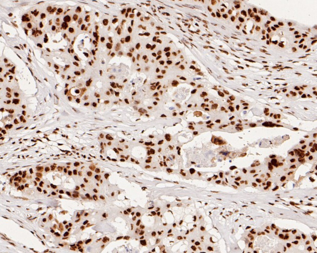 SNRPA1 Antibody in Immunohistochemistry (Paraffin) (IHC (P))