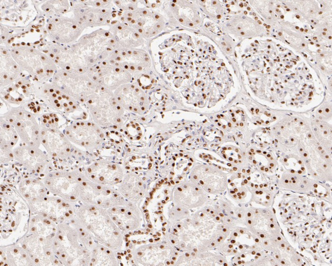 SNRPA1 Antibody in Immunohistochemistry (Paraffin) (IHC (P))