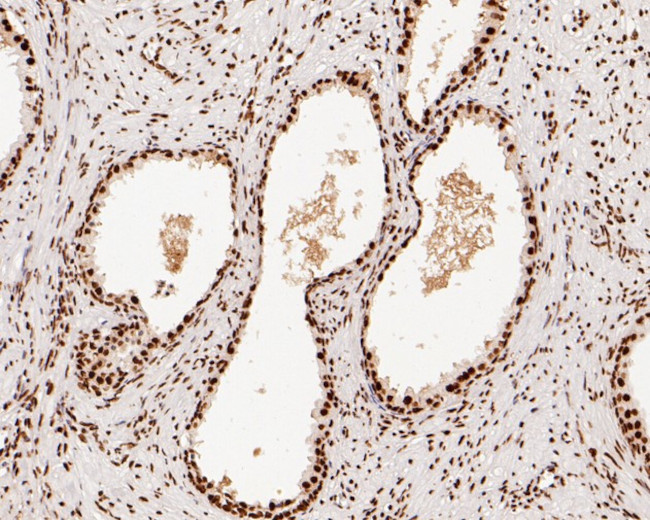 SNRPA1 Antibody in Immunohistochemistry (Paraffin) (IHC (P))