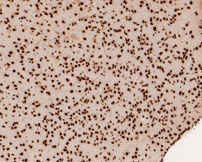 SNRPA1 Antibody in Immunohistochemistry (Paraffin) (IHC (P))