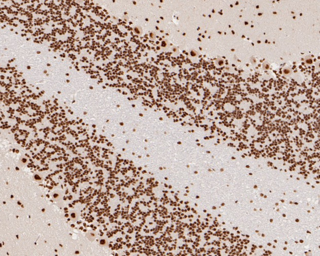 SNRPA1 Antibody in Immunohistochemistry (Paraffin) (IHC (P))