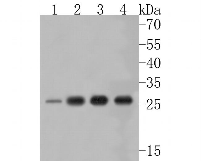 UPP1 Antibody in Western Blot (WB)