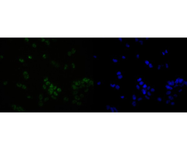 OLIG3 Antibody in Immunocytochemistry (ICC/IF)