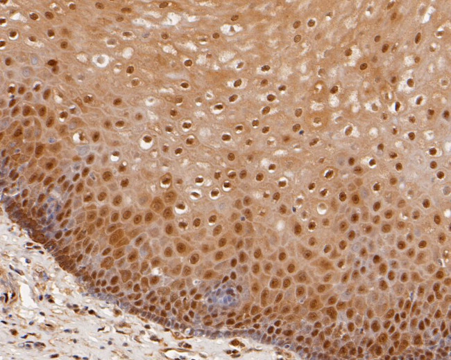 OLIG3 Antibody in Immunohistochemistry (Paraffin) (IHC (P))