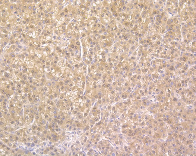 NUDT5 Antibody in Immunohistochemistry (Paraffin) (IHC (P))