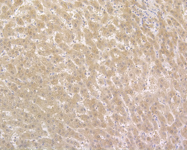 NUDT5 Antibody in Immunohistochemistry (Paraffin) (IHC (P))