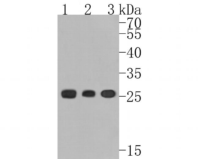 Kappa Light Chain Antibody in Western Blot (WB)