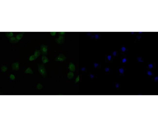 HDGF Antibody in Immunocytochemistry (ICC/IF)