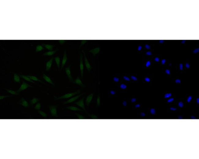 HDGF Antibody in Immunocytochemistry (ICC/IF)