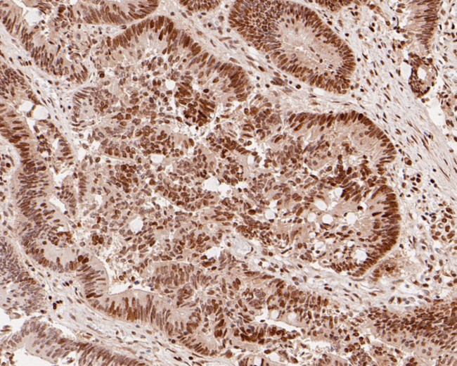 HDGF Antibody in Immunohistochemistry (Paraffin) (IHC (P))