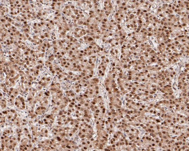 HDGF Antibody in Immunohistochemistry (Paraffin) (IHC (P))