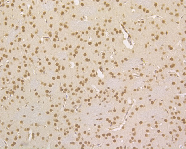 HDGF Antibody in Immunohistochemistry (Paraffin) (IHC (P))