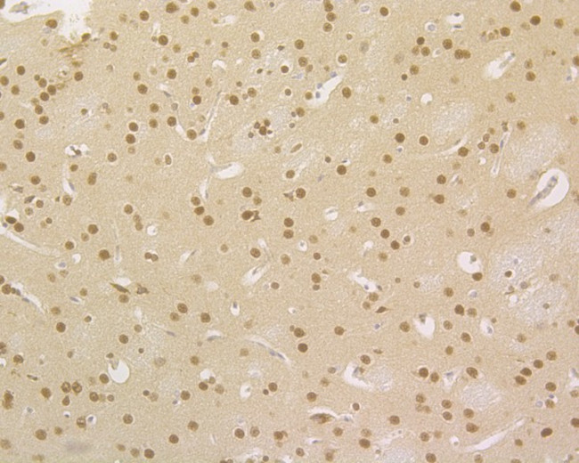 HDGF Antibody in Immunohistochemistry (Paraffin) (IHC (P))