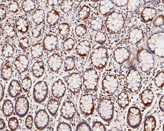 SBDS Antibody in Immunohistochemistry (Paraffin) (IHC (P))