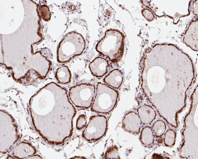 SBDS Antibody in Immunohistochemistry (Paraffin) (IHC (P))