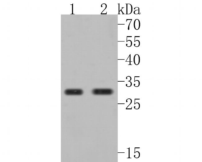 SBDS Antibody in Western Blot (WB)