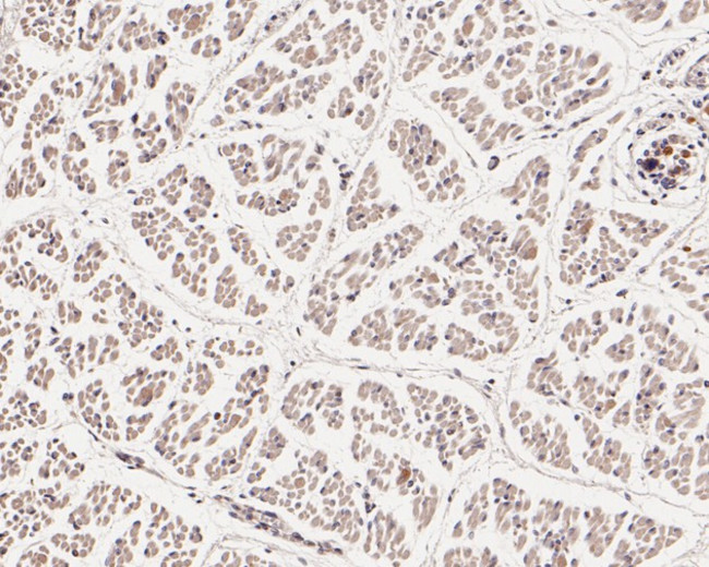 WIPI1 Antibody in Immunohistochemistry (Paraffin) (IHC (P))