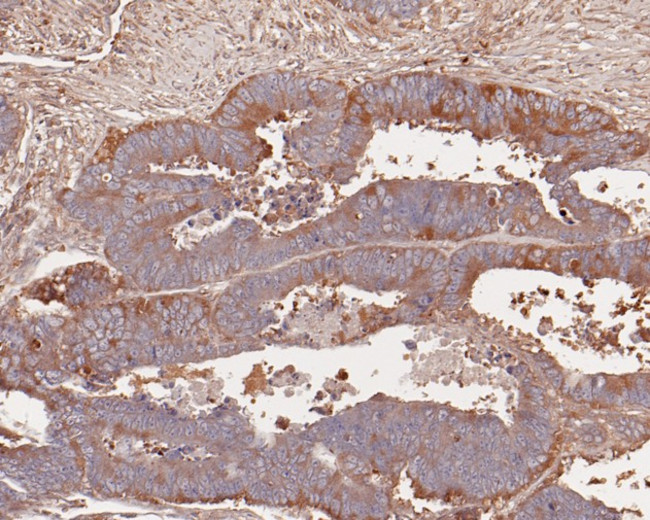 ERLIN2 Antibody in Immunohistochemistry (Paraffin) (IHC (P))