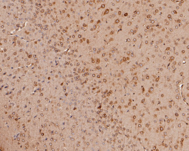 ERLIN2 Antibody in Immunohistochemistry (Paraffin) (IHC (P))