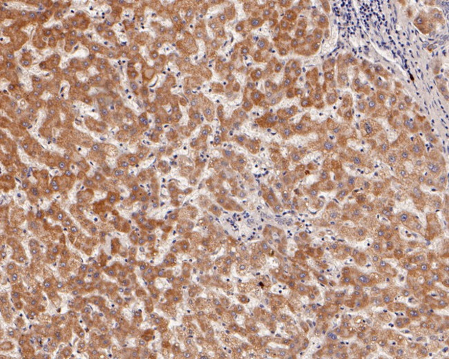 ACAA2 Antibody in Immunohistochemistry (Paraffin) (IHC (P))