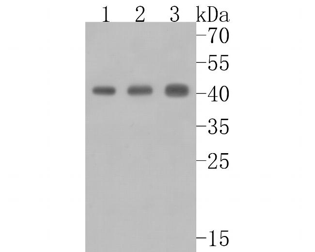 ACAA2 Antibody in Western Blot (WB)